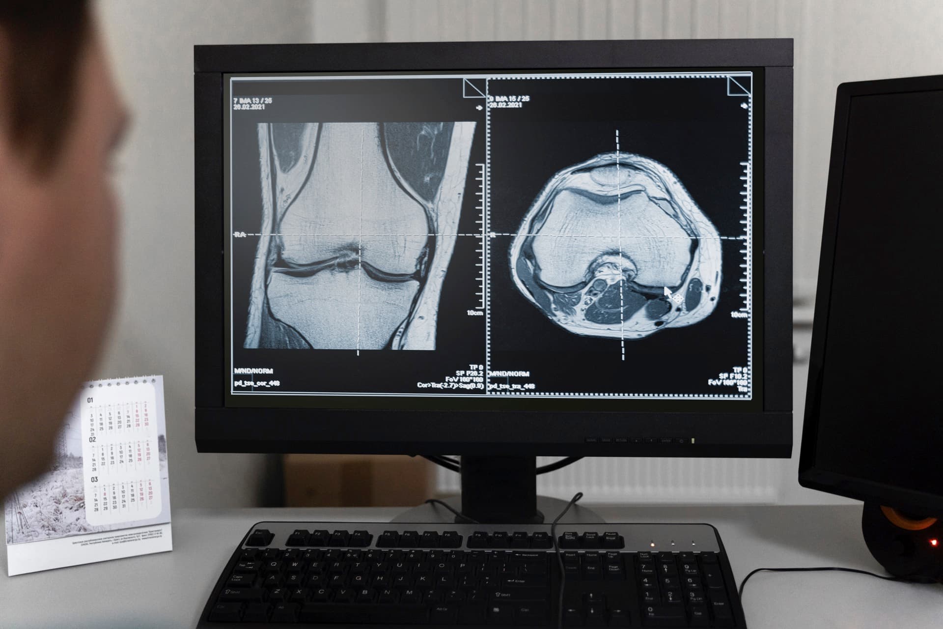 Motion-Based Biomarkers in Knee Disorders